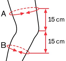Measurements for the Ottobock Genu Carezza Knee Support